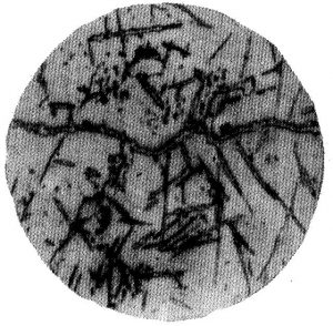 Precipitated Carbide Rating X7